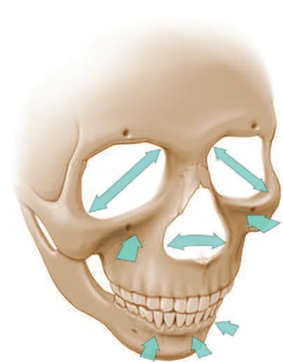 Fig 16. Directions of facial skeleton remodeling